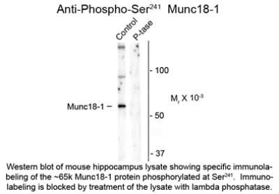 Western Blot: Syntaxin-BP1 [p Ser241] Antibody [NBP2-29507]